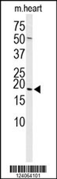 HSPB6 Antibody (Center)