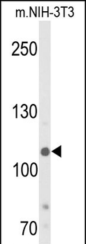 JMJD2B Antibody (T305)