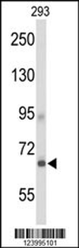 GPR133 Antibody (Center)