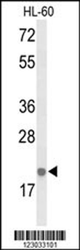 IL26 Antibody (Center)