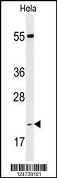PPIC Antibody (Center)