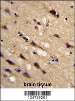 PPIC Antibody (Center)