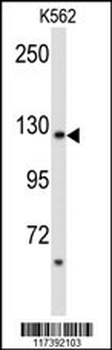 PLCB2 Antibody (N-term)