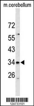 S39A3 Antibody (Center)