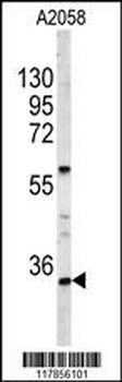 HOXA9 Antibody (C-term)