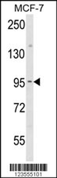 JUP Antibody (C-term)