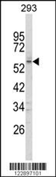 FOXC1 Antibody (C-term)