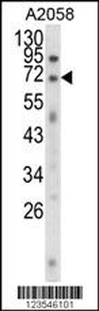 EWSR1 Antibody (C-term)