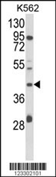 COQ3 Antibody (Center)