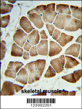 COQ3 Antibody (Center)
