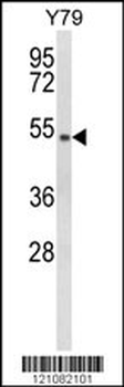 GTF2H4 Antibody (Center)