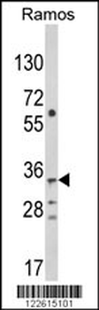 TBATA Antibody (C-term)