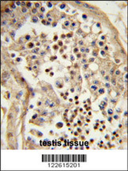 TBATA Antibody (C-term)