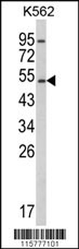CYP2E1 Antibody (C-term)