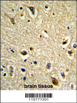 CYP2E1 Antibody (C-term)