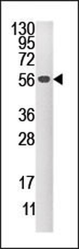 DUSP4 Antibody (C-term)