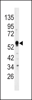 DUSP4 Antibody (C-term)