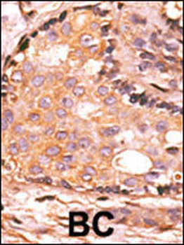 DUSP4 Antibody (C-term)