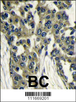 GBL Antibody (Center)