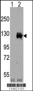 TRPM8 Antibody (C-term)