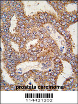 TRPM8 Antibody (C-term)