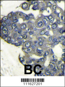 PI3KCD Antibody (N-term)