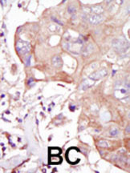 GLK Antibody (C-term)