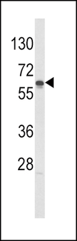 GCK Antibody (C-term)