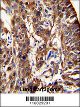 ALDH3A1 Antibody (N-term)