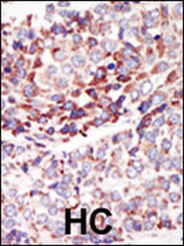 TEK (TIE2) Antibody (C-term)