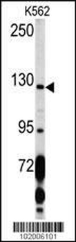 PDGFRA Antibody (C-term E1063)
