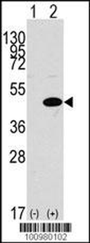 MAPK3 Antibody (N-term)