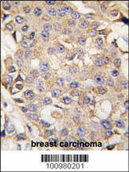 MAPK3 Antibody (N-term)