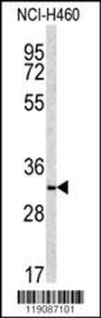 NQO1 Antibody (Center)