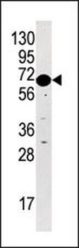 STK29 Antibody (C-term)