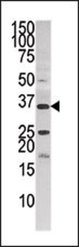 PANK3 Antibody (Center)