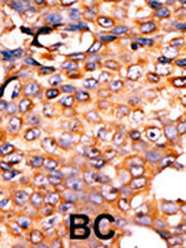 PANK3 Antibody (Center)