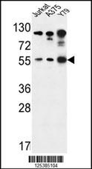 AKT1 Antibody (S129)