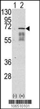 Activin Receptor Type IA (ACVR1) Antibody (Center N153)
