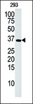 Deoxyguanosine Kinase (DGUOK) Antibody (N-term)
