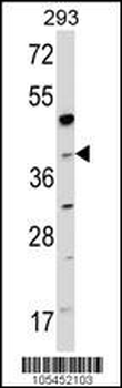 NAGK Antibody (C-term)