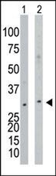 NAGK Antibody (N-term)