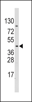 PDK4 Antibody (E265)