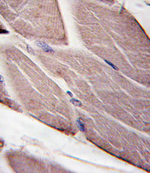 PDK4 Antibody (E265)