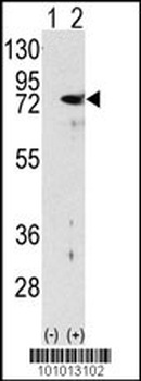 PKC delta Antibody (N-term)