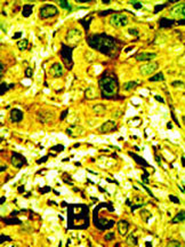PKC delta Antibody (N-term)