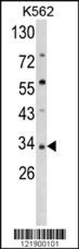 SFRP5 Antibody (Center)