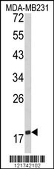 CD28 Antibody (C-term)