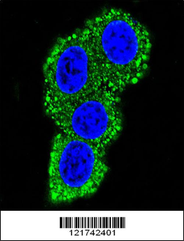 CD28 Antibody (C-term)