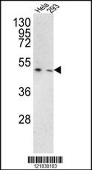 TMPRSS3 Antibody (Center)
